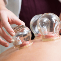 Persona recibiendo terapia cupping focalizado en un punto de dolor en la espalda.