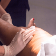 Masaje de Drenaje Linfático – Detox y Bienestar Persona recibiendo un masaje de drenaje linfático en las piernas.